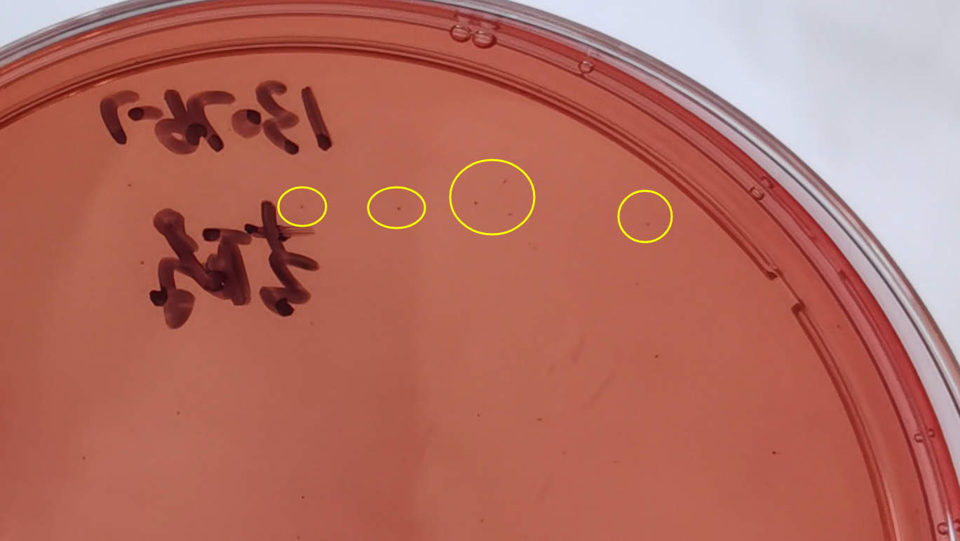 VRBA內(nèi)的紅色小菌落，有可能是沙門氏菌？