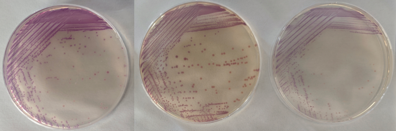沙門檢測(cè)新助手—沙門氏+顯色培養(yǎng)基