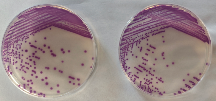 沙門檢測(cè)新助手—沙門氏+顯色培養(yǎng)基